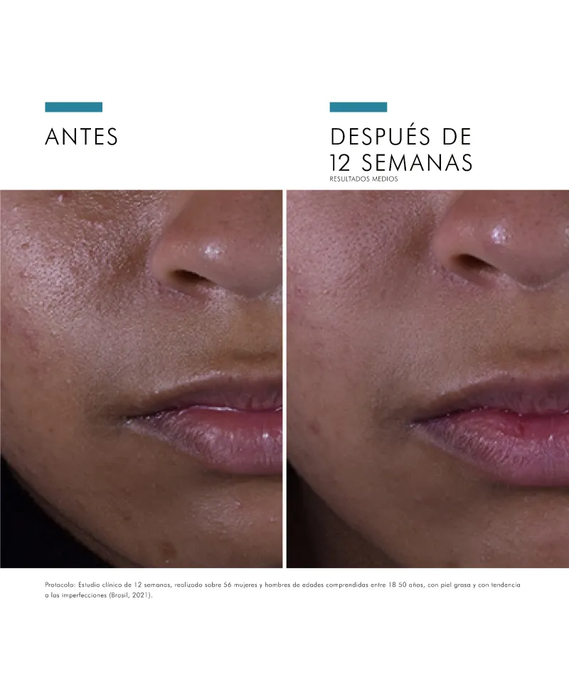 Skinceuticals Silymarin CF Serum Piel Grasa 30ml