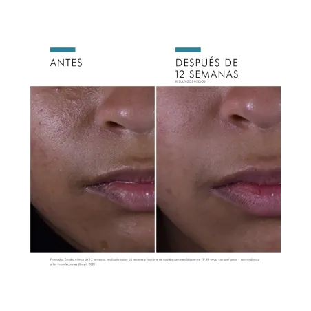 Skinceuticals Silymarin CF Serum Piel Grasa 30ml