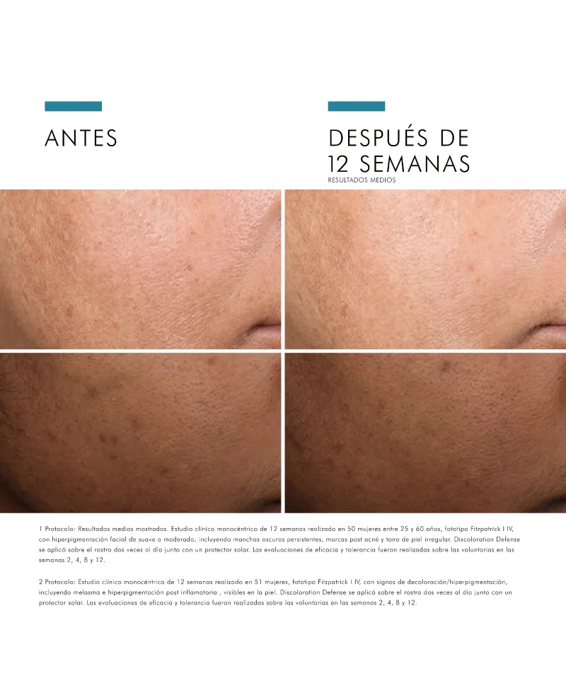 Skinceuticals Discoloration Defense Sérum 30 ml