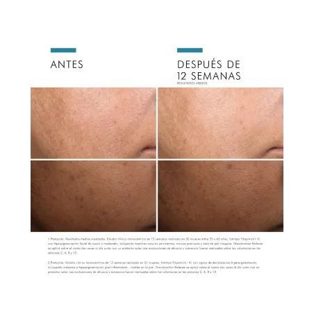 Skinceuticals Discoloration Defense Sérum 30 ml