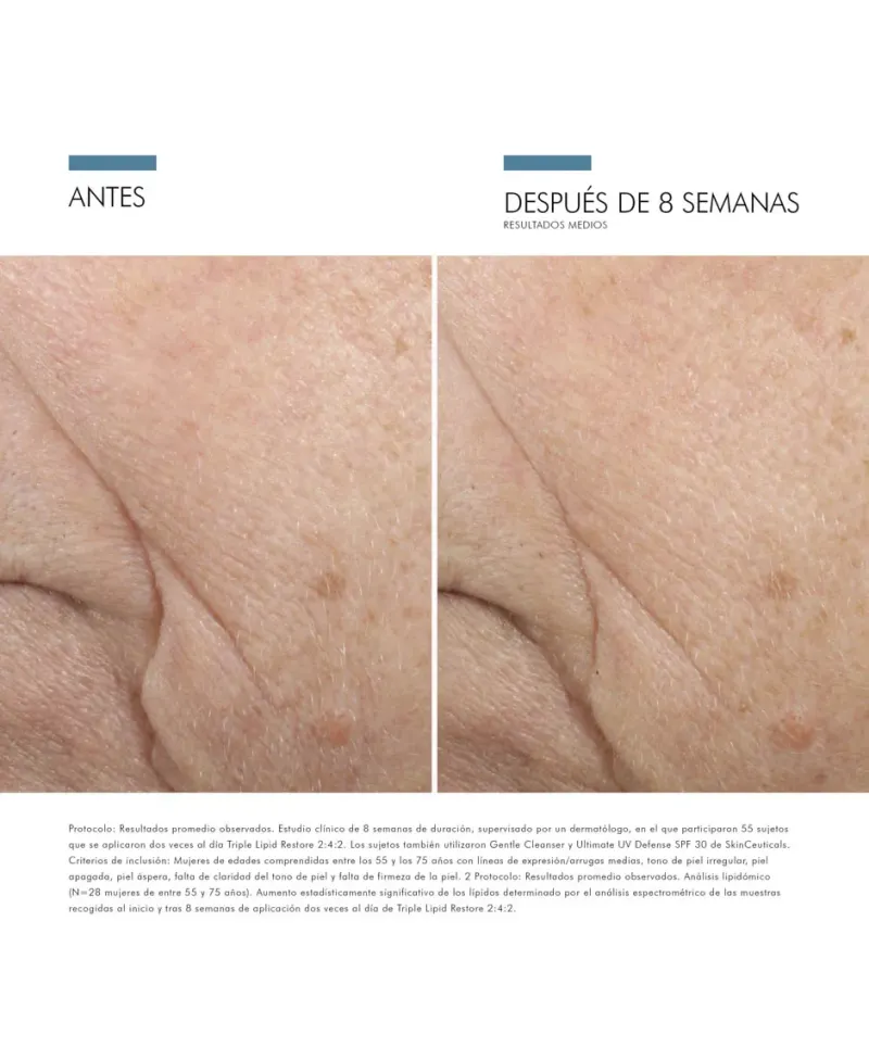Skinceuticals Triple Lipid Restore 2:4:2 Tratamiento Antiedad 50 ml
