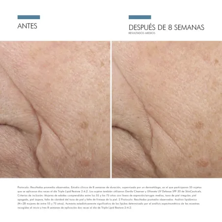 Skinceuticals Triple Lipid Restore 2:4:2 Tratamiento Antiedad 50 ml