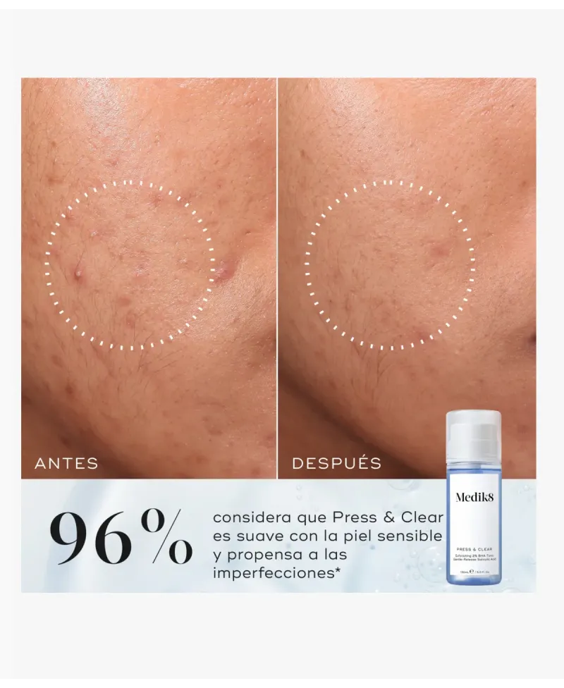 Medik8 Press & Clear Tónico Exfoliante 2% BHA 150 ml