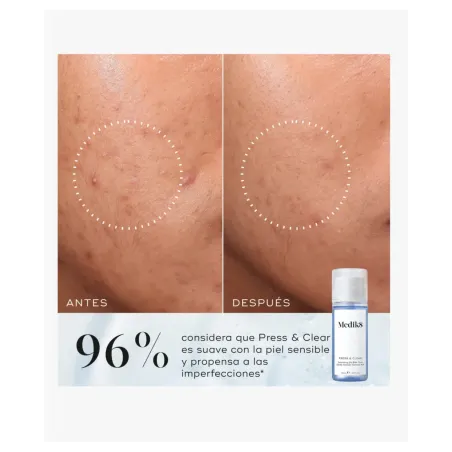 Medik8 Press & Clear Tónico Exfoliante 2% BHA 150 ml
